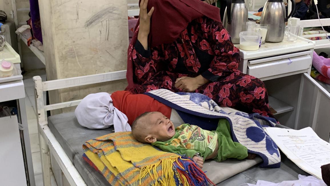 يعاني آلاف أطفال أفغانستان من سوء التغذية (محمد نوري/ الأناضول)