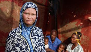 رقية امرأة مصابة بالمهق في مالي في أفريقيا 1 (الأناضول)