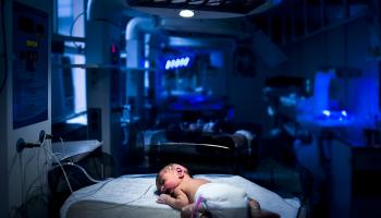 الطفل المصاب بمتلازمة يتطلب من الأهل فور ولادته خضوعه لعملية جراحية فورية (أنينديتو موخيرجي/ Getty)