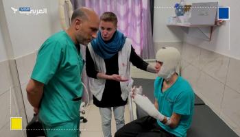 منظمة أطباء بلا حدود في غزة تتحدث عن صعوبات في علاج ضحايا الحروق