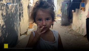 أمراض جلدية تفتك بالأطفال الفلسطينيين في أماكن النزوح بغزّة	