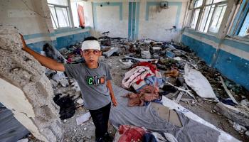 طفل مصاب في مخيم النصيرات جراء القصف الإسرائيلي 7 يونيو 2024 (Getty)
