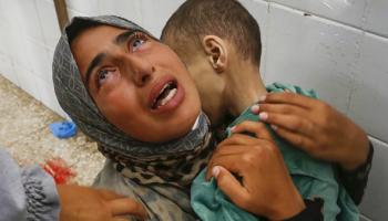 سوء التغذية في غزة يهدد حياة الأطفال، 14 يونيو 2024 (الأناضول)