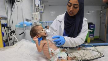 سوء التغذية يهدد حياة اطفال غزة، 9 يوليو 2024 (فرانس برس)