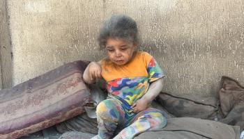 طفلة تبكي بعد إصابتها بقصف استهدف مدرسة تابعة لوكالة أونروا وسط قطاع غزة، 17 يوليو 2024 (Getty)